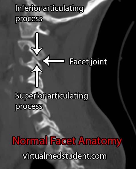 Normal Facet Anatomy