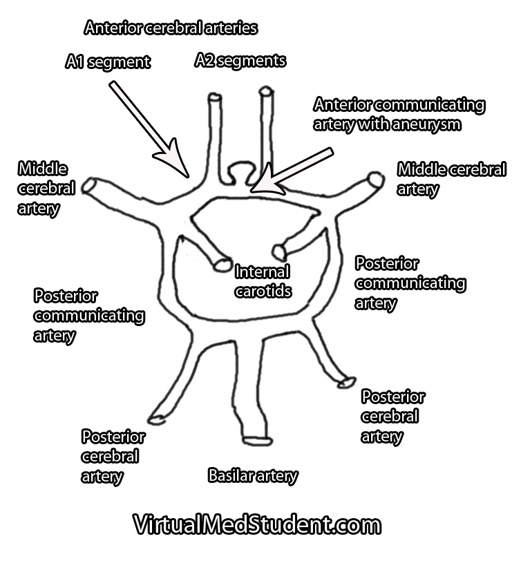 Basilar Tip Schematic Drawing