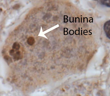 Bunina Bodies