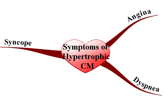 Symptoms and Signs of Hypertrophic Cardiomyopathy